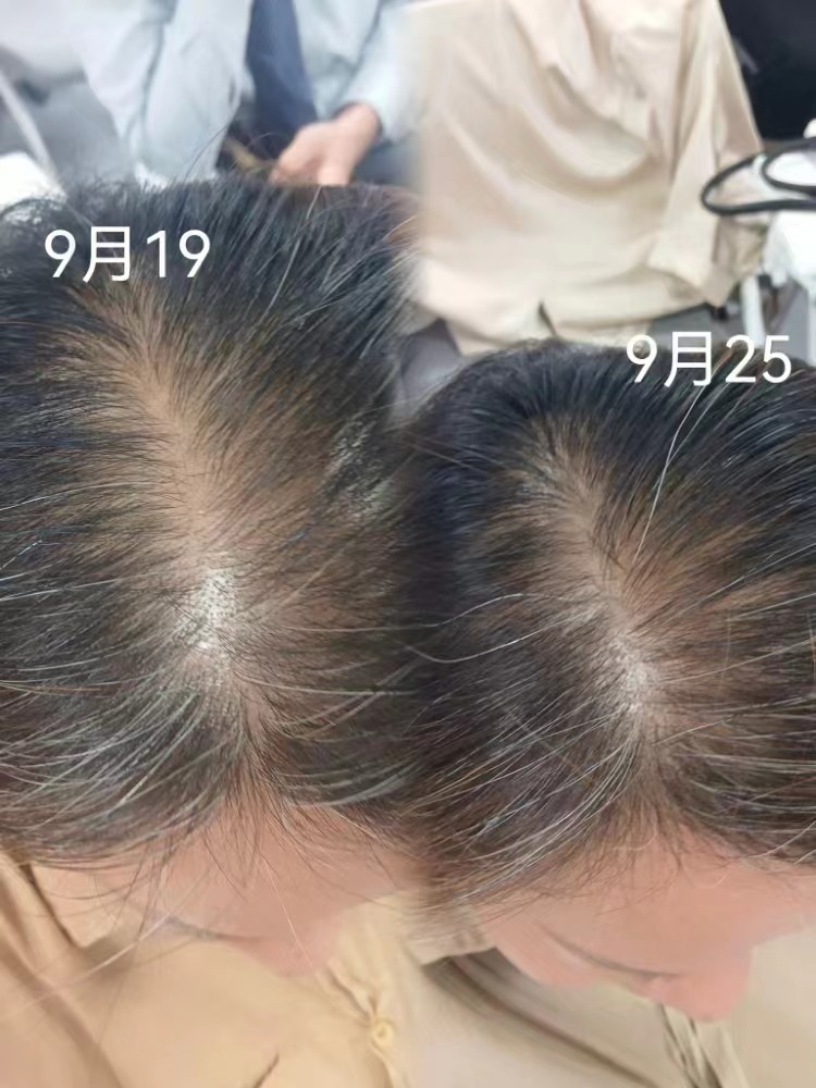 客户反馈