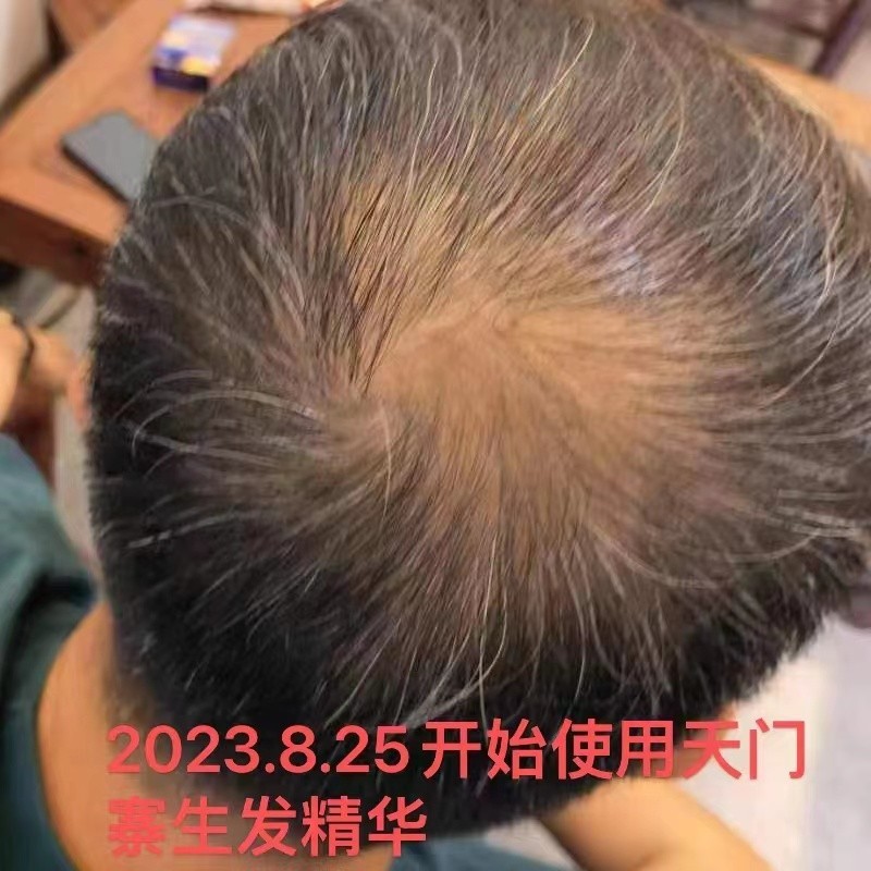客户反馈